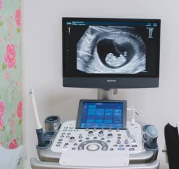 echo prenatale screening